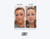 Million Dollar Empire microneedling pen and cartridges (10)