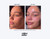 Million Dollar Empire microneedling pen and cartridges (10)