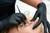 Million Dollar Facial dermaplaning kit