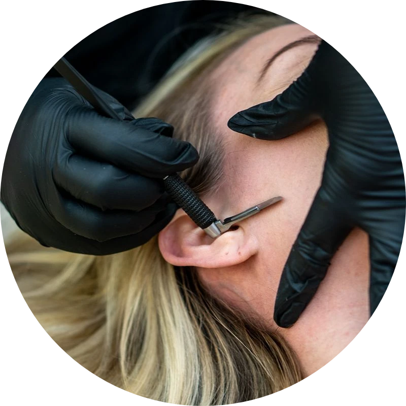 Dermaplaning