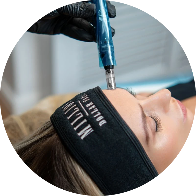 Microneedling
