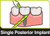X-Floss Dental Floss 30pk