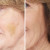 Corrective Colors Concealer