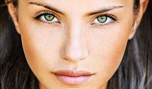How to Get Rid of Freckles