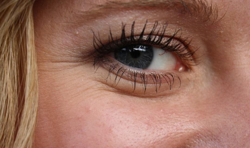 How To Get Rid Of Under Eye Wrinkles