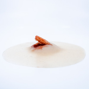 Laceration with Skin Flap 1