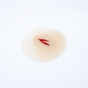 Laceration Forked Shallow