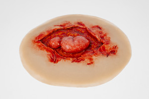 Medical Grade silicone wound, Evisceration with Open Wound. 01 light skin tone
