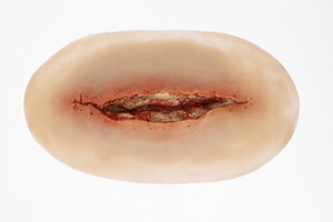 Medical Grade silicone wound, Dehiscence Large. 01 light skin tone Medical Grade silicone wound, Dehiscence Large. 01 light skin tone