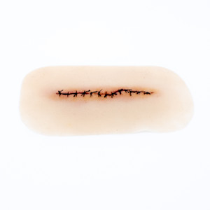 Medical Grade silicone wound, Suture Line Healing. 01 light skin tone