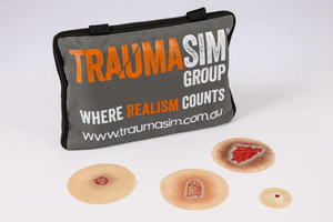 Clinical Ulcer Range