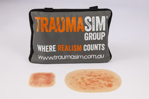 Clinical Rash and Hives Range