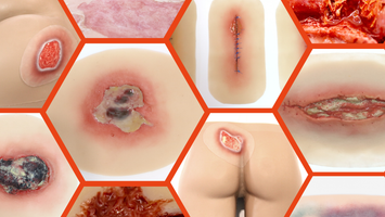 Clinical Simulation and the Importance of Realistic Simulation Wounds