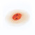 Medical Grade silicone wound, Ulcer - Large. 01 light skin tone