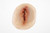 Medical Grade silicone wound, Dehiscence Large. 01 light skin tone