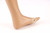 Foot Ulcer - Neuropathic