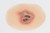 Medical Grade silicone wound, Infected Open Wound. 01 light skin tone