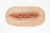 Dehiscence Medium