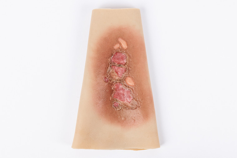 TraumaWear has been specifically designed for use where trainers do not have the time or ability to provide intricate moulage and allows easy/quick application and removal of wounds or injuries that can be enhanced realistically & quickly using Stage Blood or Fresh Scab.