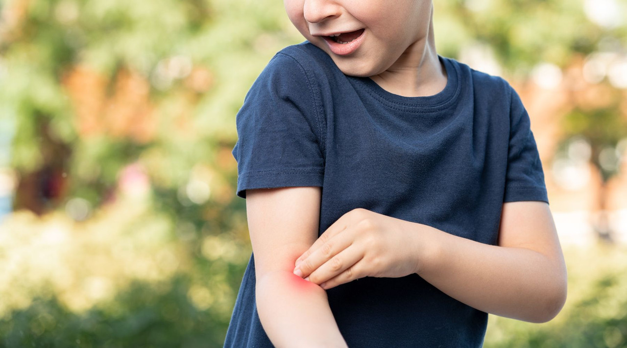 Understanding the Needs of Dry, Sensitive, and Eczema-Prone Skin