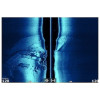 Lowrance ELITE 7 FS Combo Including Active Imaging 3-in-1 Transducer