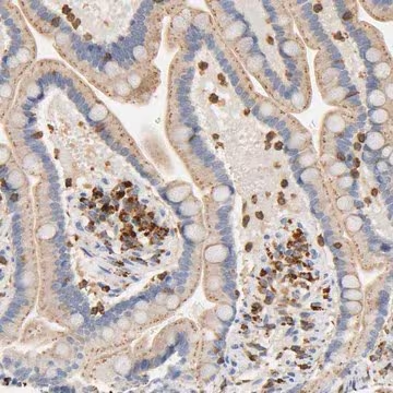 Anti-UCKL1 antibody produced in rabbit, 1 X 100 µL (HPA004769-100UL)