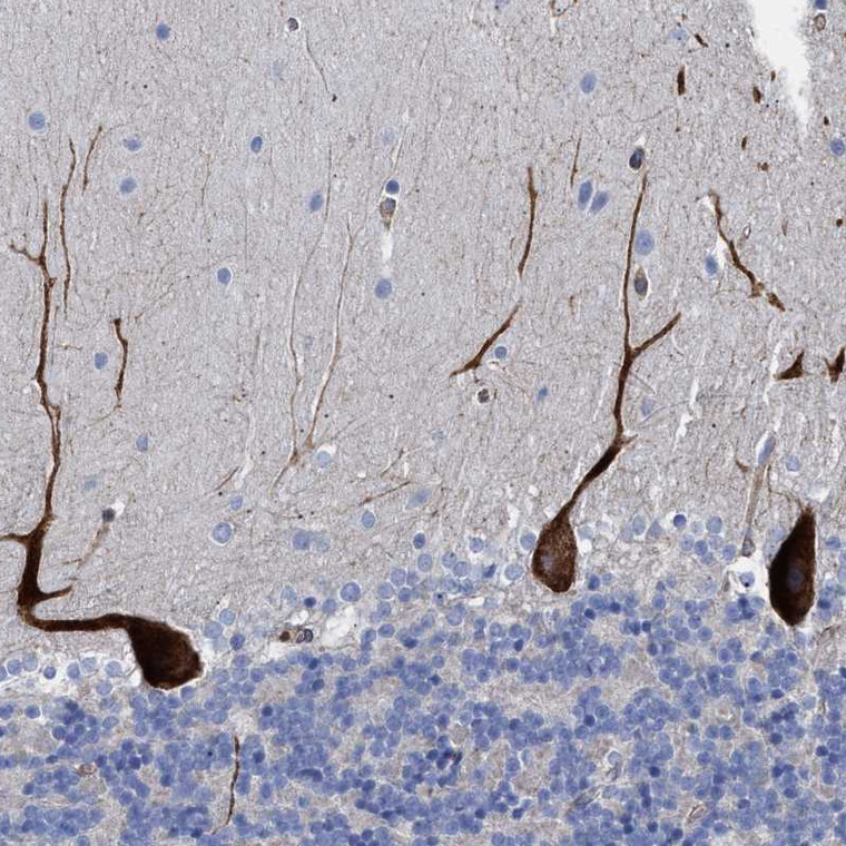 Anti-HS3ST5 Antibody, Polyclonal (HPA021823) | Atlas Antibodies™