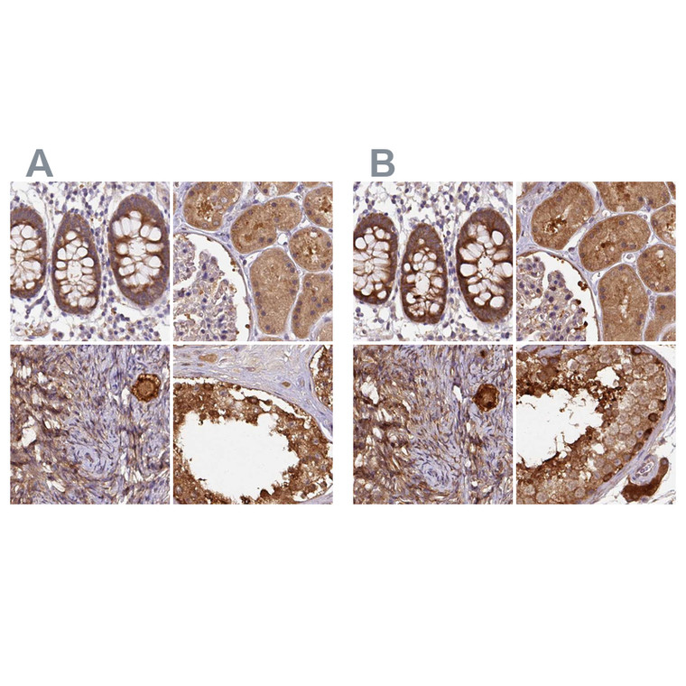 Anti-ST13 Antibody, Polyclonal, 100µL (HPA046412) | Atlas Antibodies™