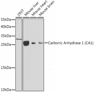 Western blot analysis of various lysates using Carbonic Anhydrase 1 (CA1) Rabbit pAb (A1031) at 1:1000 dilution.<br/>Secondary antibody: HRP-conjugated Goat anti-Rabbit IgG (H+L) (AS014) at 1:10000 dilution.<br/>Lysates/proteins: 25μg per lane.<br/>Blocking buffer: 3% nonfat dry milk in TBST.<br/>Detection: ECL Basic Kit (RM00020).<br/>Exposure time: 30s.