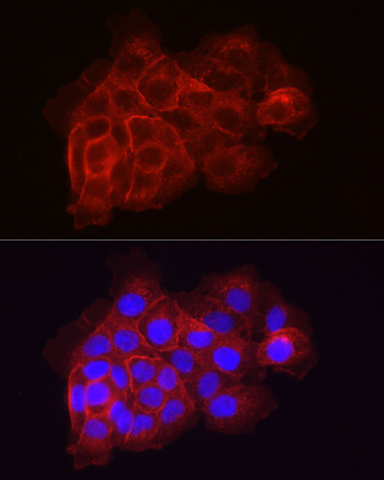 Coagulation factor III/Tissue Factor Rabbit pAb, Polyclonal (A1378) | ABclonal Technology™