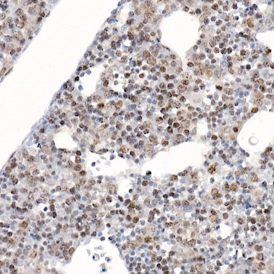 Survivin Rabbit pAb, Polyclonal (A1551) | ABclonal Technology™