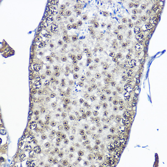 Casein Kinase 2 beta (CSNK2B) Rabbit pAb, Polyclonal (A17467) | ABclonal Technology™