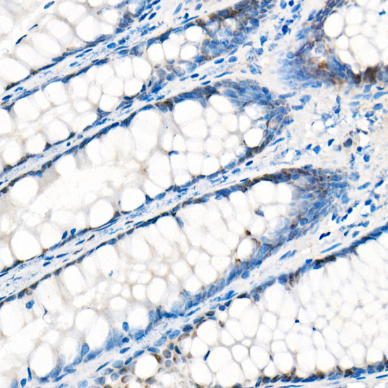 KO Validated] YAP1 Rabbit mAb, Monoclonal (A19134) | ABclonal