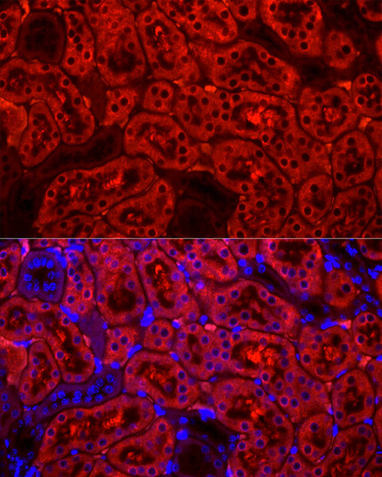 Cytochrome P450 2E1 (CYP2E1) Rabbit mAb, Monoclonal (A23030) | ABclonal Technology™