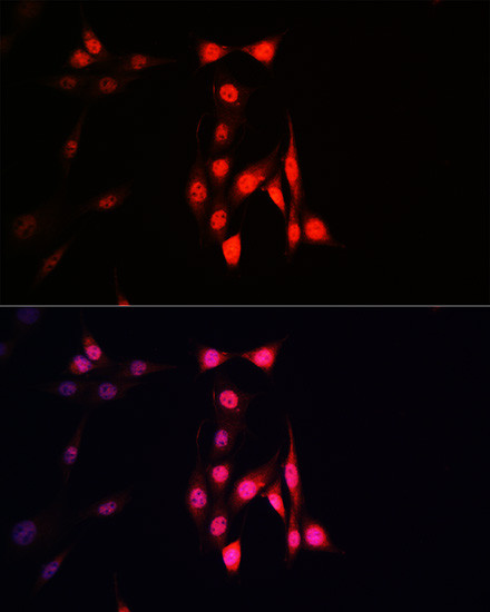 Ubiquitin Rabbit mAb, Monoclonal (A23483) | ABclonal Technology™