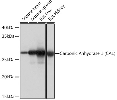 Western blot analysis of various lysates using Carbonic Anhydrase 1 (CA1) (CA1) Rabbit mAb (A4406) at 1:1000 dilution.<br/>Secondary antibody: HRP-conjugated Goat anti-Rabbit IgG (H+L) (AS014) at 1:10000 dilution.<br/>Lysates/proteins: 25μg per lane.<br/>Blocking buffer: 3% nonfat dry milk in TBST.<br/>Detection: ECL Basic Kit (RM00020).<br/>Exposure time: 1s.