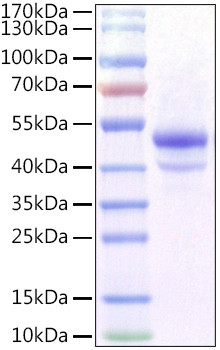 Recombinant Mouse Carbonic Anhydrase IX/CA9 Protein was determined by SDS-PAGE under reducing conditions with Coomassie Blue.