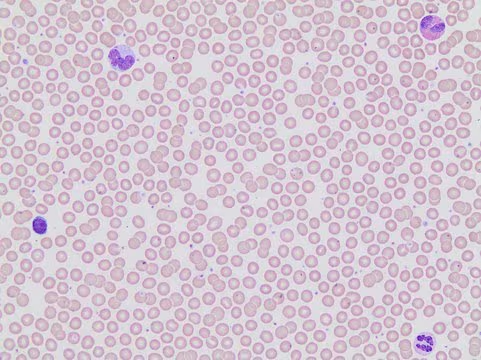 Automated Wright Stain Set, 1 X 1 set (WSHT-1SET)