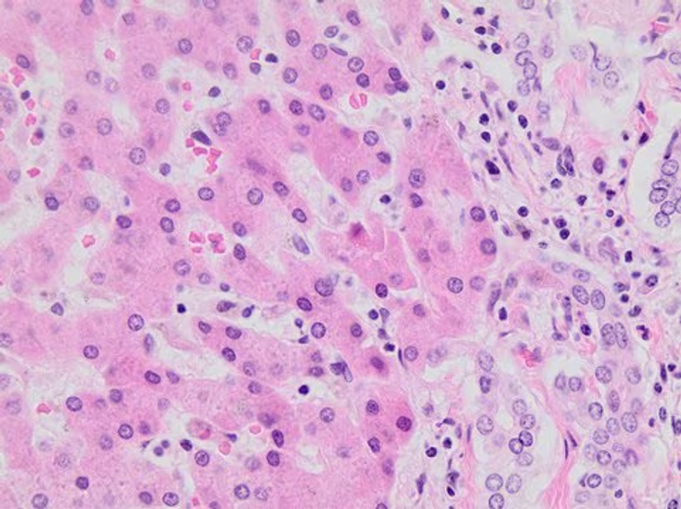 Eosin Y Solution, Aqueous, 1 X 2.5 L (HT110280-2.5L)