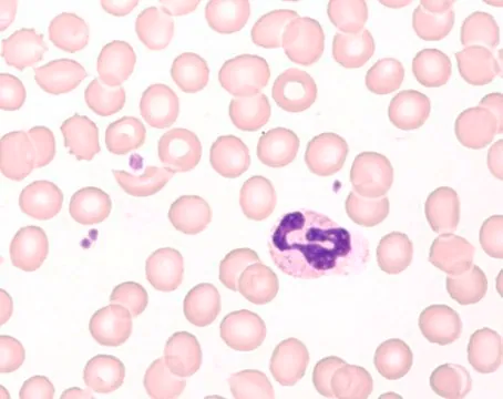 Hemacolor® Rapid staining of blood smear, 1 X 2.5 L (1119552500)