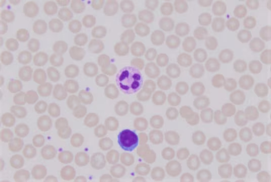 Giemsa Stain, Modified, 1 X 500 mL (GS500-500ML)