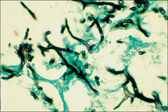 Silver Stain (Modified GMS) Kit, 1 X 1 kit (HT100A-1KT)