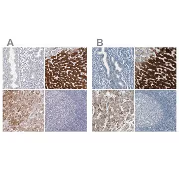 Anti-CYP2E1 antibody produced in rabbit, 1 X 100 µL (HPA029564-100UL)