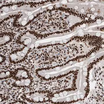 Anti-NCL antibody produced in rabbit, 1 X 100 µL (HPA023981-100UL)