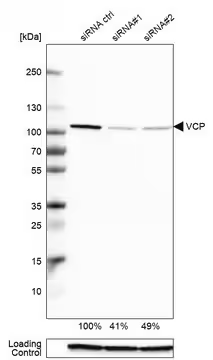 Anti-VCP antibody produced in rabbit, 1 X 100 µL (HPA012728-100UL)