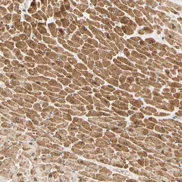 Anti-ADAM17 antibody produced in rabbit, 1 X 100 µL (HPA010738-100UL)