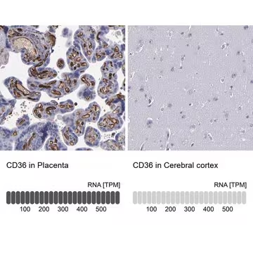 Anti-CD36 antibody produced in rabbit, 1 X 100 µL (HPA002018-100UL)