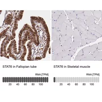 Anti-STAT6 antibody produced in rabbit, 1 X 100 µL (HPA001861-100UL)