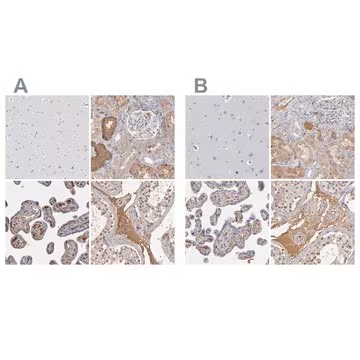 Anti-SERPINA1 antibody produced in rabbit, 1 X 100 µL (HPA000927-100UL)