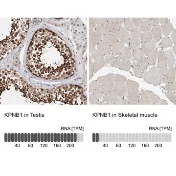 Anti-KPNB1 antibody produced in rabbit, 1 X 100 µL (HPA029878-100UL)